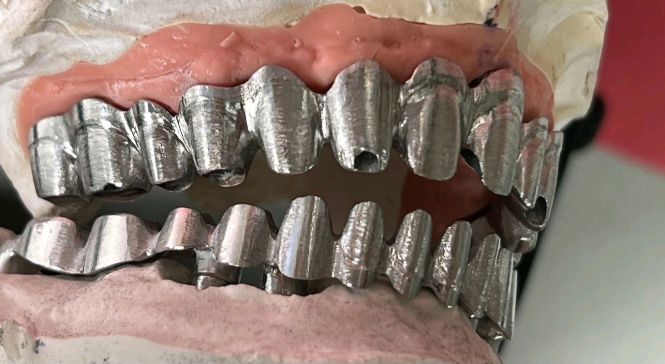 Dental prosthetic restoration work 1