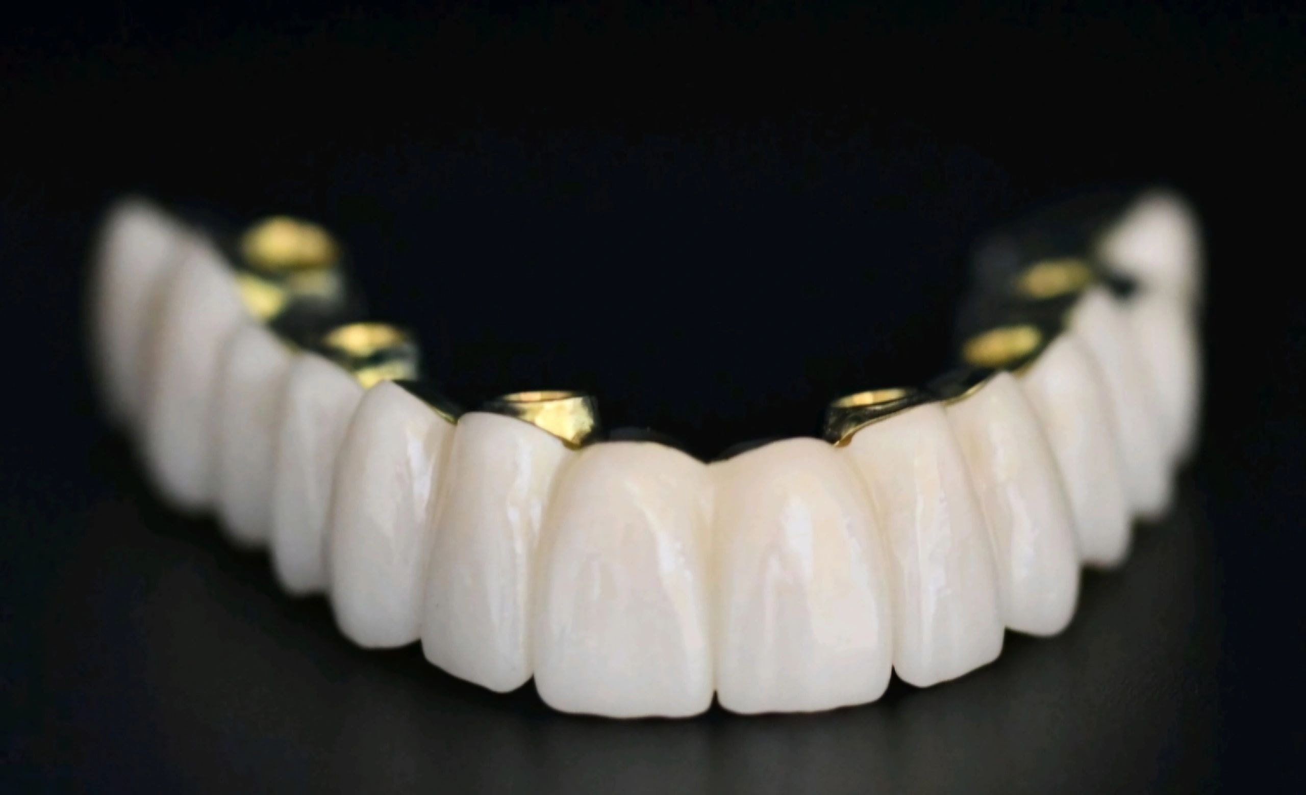 Dental prosthetic restoration work 10