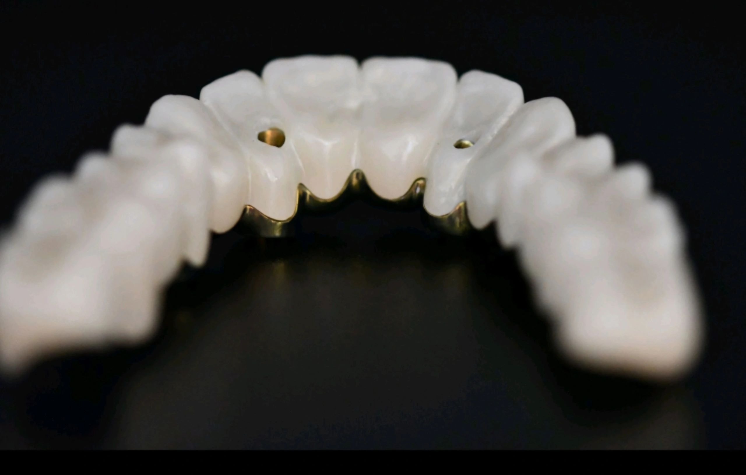 Dental prosthetic restoration work 2
