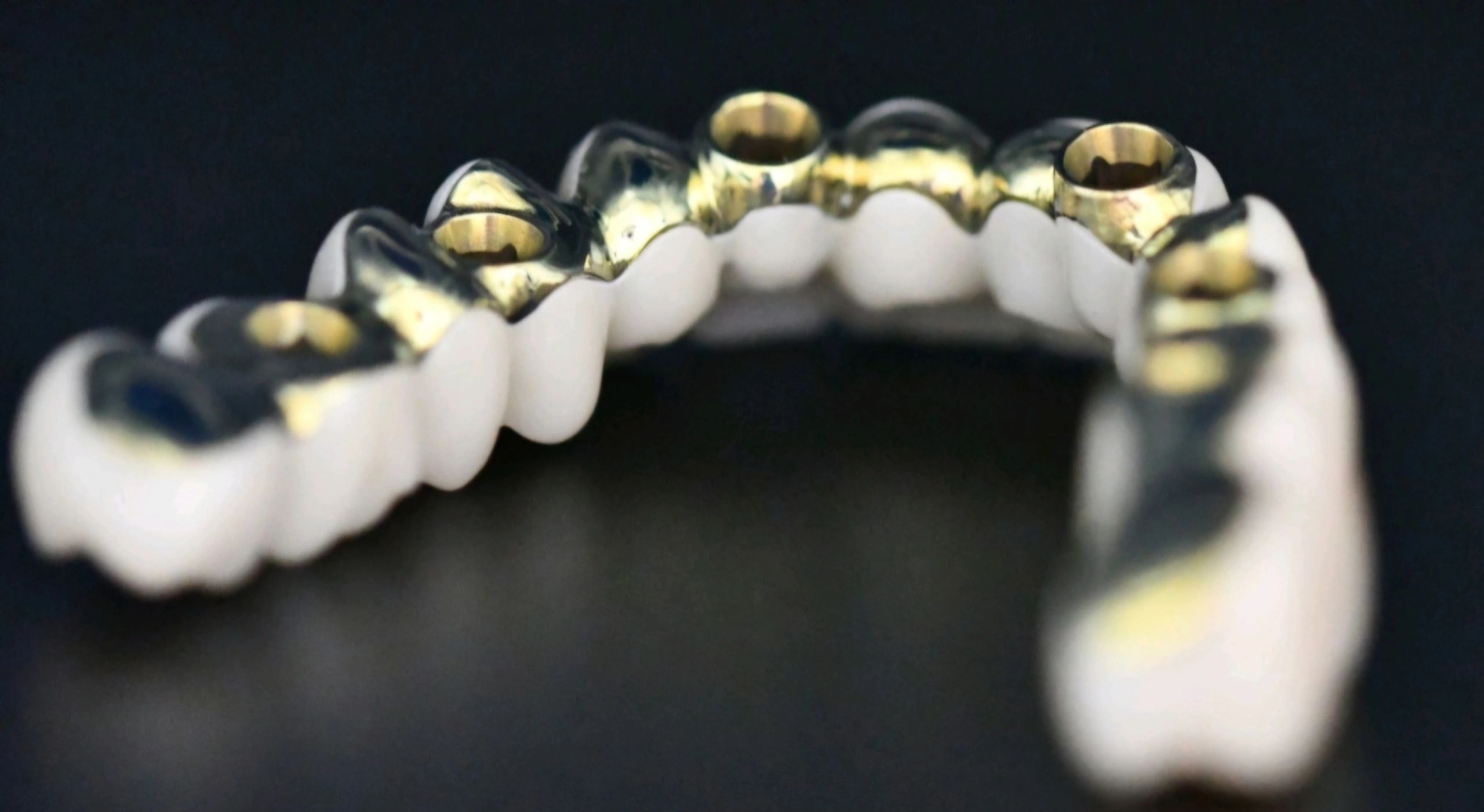Dental prosthetic restoration work 4
