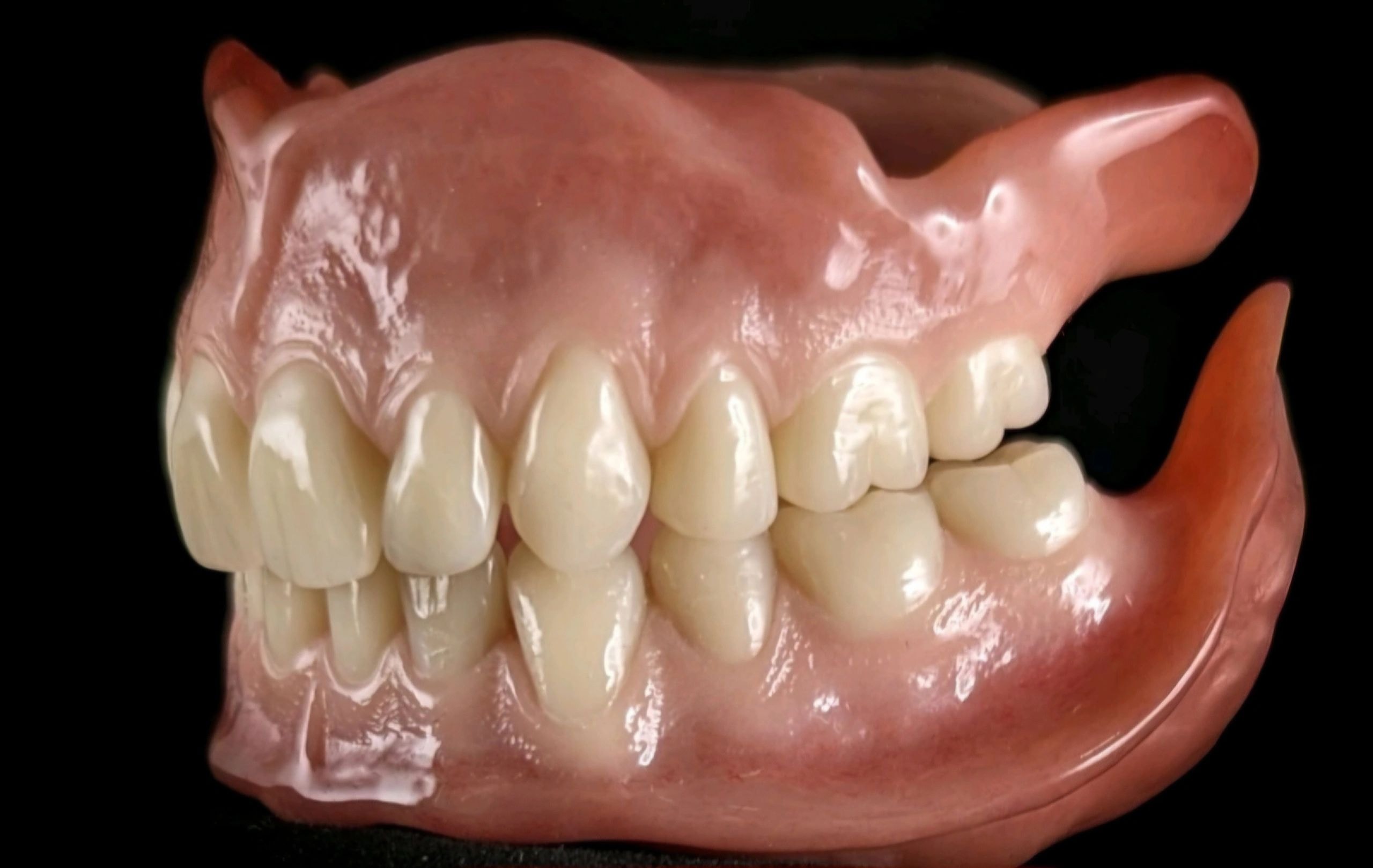 Dental prosthetic restoration work 5